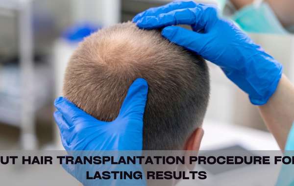 FUT Hair Transplantation Procedure for Lasting Results