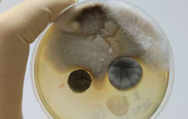 The Benefits of Professional Mould Testing Services